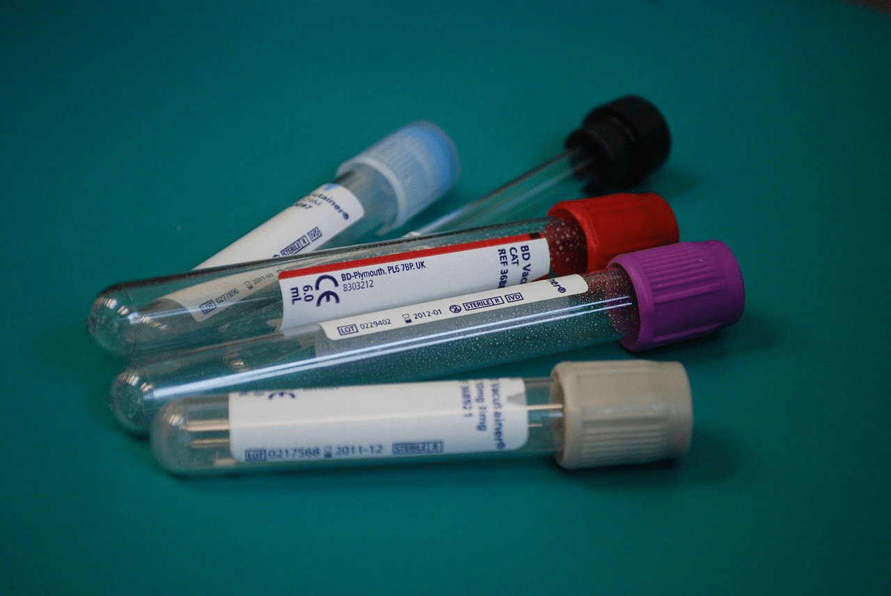 hepatitis