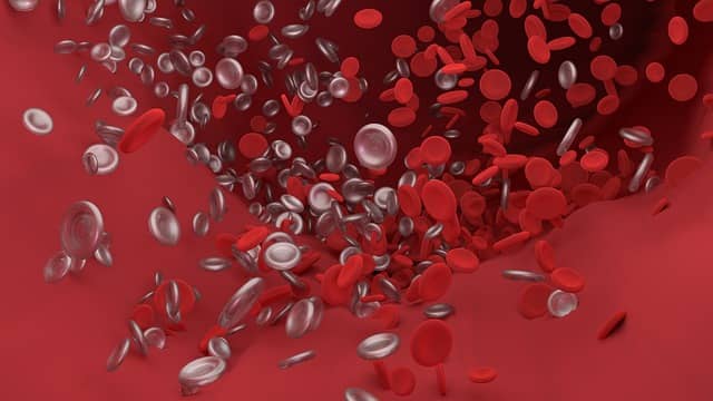 blood clot