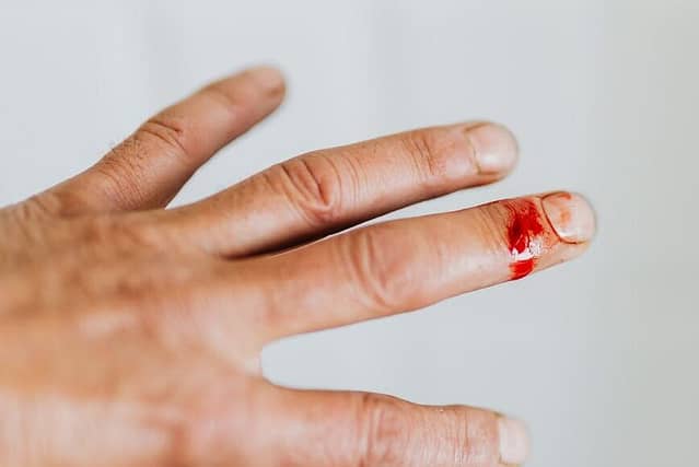 crop man hand with cut finger wound and blood clot